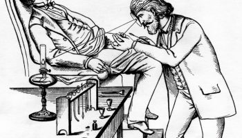 Urethroscopy according to Joseph Grünfeld