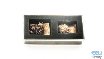 Bladder stone “Sputnik”