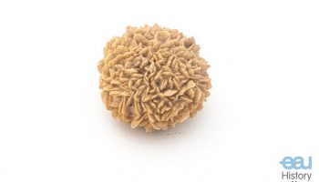 Bladder stone “Sonne”