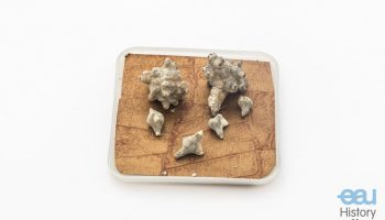 Bladder stones “Morgenstern”