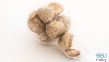 Bladder stones