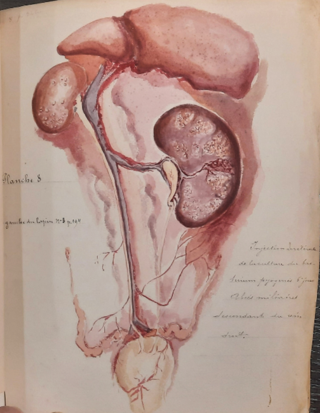 Watercolor of Joaquin Albarran doctoral thesi